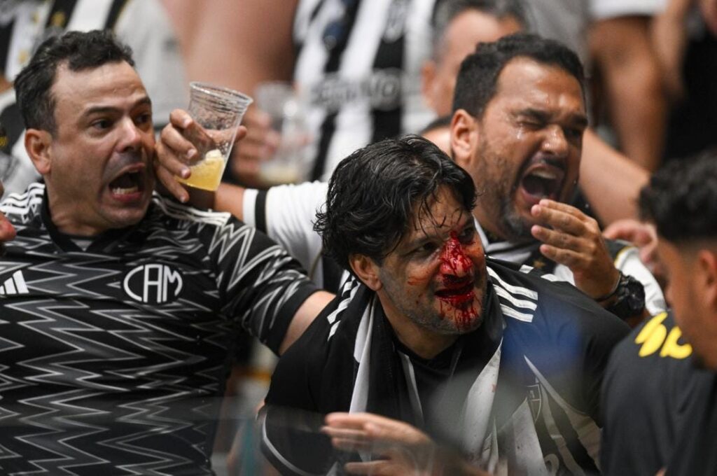 Torcedor do Atlético-MG com rosto sangrando em confusão durante jogo que teve Flamengo campeão da Copa do Brasil na Arena MRV